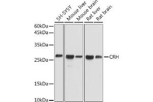 Western blot analysis of extracts of various cell lines, using CRH antibody (ABIN3021479, ABIN3021480, ABIN3021481 and ABIN6215115) at 1:1000 dilution. (CRH 抗体  (AA 25-194))