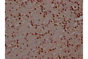 IHC image of ABIN7127607 diluted at 1:100 and staining in paraffin-embedded human brain tissue performed on a Leica BondTM system. (Recombinant MAD2L2 抗体)