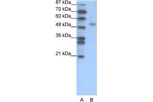 Human Jurkat; WB Suggested Anti-FOXD2 Antibody Titration: 1. (FOXD2 抗体  (N-Term))