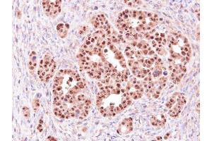 IHC-P Image Immunohistochemical analysis of paraffin-embedded NCI-N87 xenograft, using ALOXE3, antibody at 1:500 dilution. (ALOXE3 抗体)