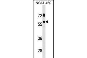 DDX19B Antibody (N-term) (ABIN1881254 and ABIN2838987) western blot analysis in NCI- cell line lysates (35 μg/lane). (DDX19B 抗体  (N-Term))