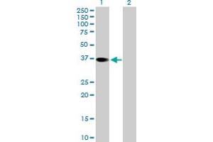 Western Blot analysis of RBKS expression in transfected 293T cell line by RBKS MaxPab polyclonal antibody. (Ribokinase 抗体  (AA 1-322))