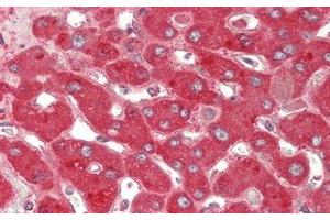 Detection of CP in Human Liver Tissue using Polyclonal Antibody to Ceruloplasmin (CP) (Ceruloplasmin 抗体  (AA 789-1065))