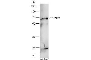 Mouse liver lysates probed with Rabbit Anti-TNFAIP2 Polyclonal Antibody, Unconjugated  at 1:5000 for 90 min at 37˚C.