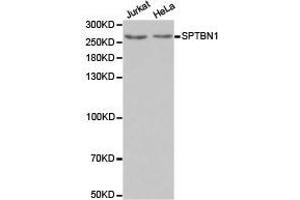 Western Blotting (WB) image for anti-Spectrin Beta, Non-Erythrocytic 1 (SPTBN1) antibody (ABIN1874930) (SPTBN1 抗体)