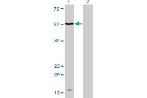 Western Blot analysis of MAGOH expression in transfected 293T cell line by MAGOH monoclonal antibody (M02), clone 4H8.
