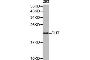 Western blot analysis of extracts of 293T cells, using DUT antibody (ABIN6292370). (Deoxyuridine Triphosphatase (DUT) 抗体)