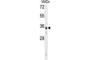 WDR5B Antibody (N-term) western blot analysis in WiDr cell line lysates (35 µg/lane). (WDR5B 抗体  (N-Term))