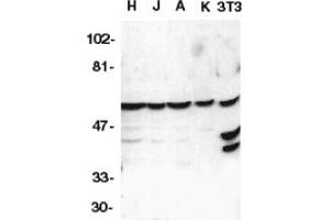 Image no. 1 for anti-Caspase 10, Apoptosis-Related Cysteine Peptidase (CASP10) (AA 505-521) antibody (ABIN201420) (Caspase 10 抗体  (AA 505-521))