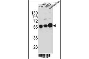 Western blot analysis in HL-60,K562 cell line and mouse cerebellum tissue lysates (35ug/lane). (CAMK1G 抗体  (AA 211-241))