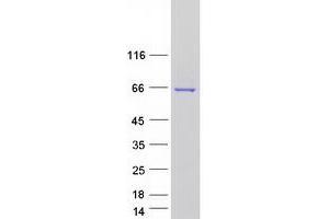 Western Blotting (WB) image for THUMP Domain Containing 3 (THUMPD3) (Transcript Variant 2) protein (Myc-DYKDDDDK Tag) (ABIN2733609)