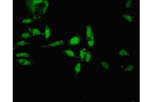 Immunofluorescent analysis of Hela cells using ABIN7151766 at dilution of 1:100 and Alexa Fluor 488-congugated AffiniPure Goat Anti-Rabbit IgG(H+L)