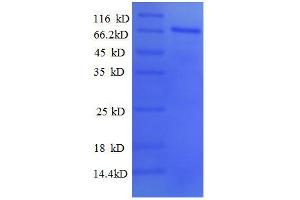 SDS-PAGE (SDS) image for Paired Box Gene 2a (PAX2A) (AA 1-363), (partial) protein (GST tag) (ABIN1047491) (PAX2A Protein (AA 1-363, partial) (GST tag))