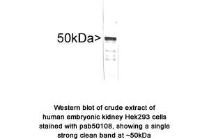 Image no. 1 for anti-Vimentin (VIM) antibody (ABIN363417)