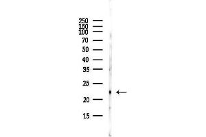 anti-Claudin 1 (CLDN1) (C-Term) antibody
