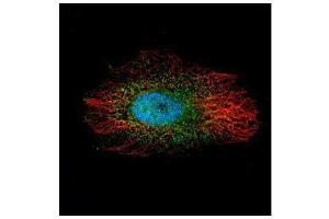 ICC/IF Image Confocal immunofluorescence analysis (Olympus FV10i) of paraformaldehyde-fixed HeLa, using LIM kinase 2, antibody (Green) at 1:500 dilution. (LIMK2 抗体)