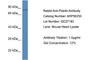 Western Blotting (WB) image for anti-phosphodiesterase 4B, cAMP-Specific (PDE4B) (N-Term) antibody (ABIN785795) (PDE4B 抗体  (N-Term))
