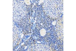 Immunohistochemistry of paraffin-embedded rat ovary using MYOG antibody (ABIN5974015) at dilution of 1/100 (20x lens). (Myogenin 抗体)