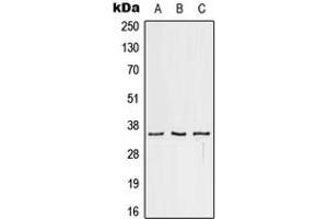 Western blot analysis of CD32c expression in HeLa (A), Raw264. (FCGR2C 抗体  (C-Term))