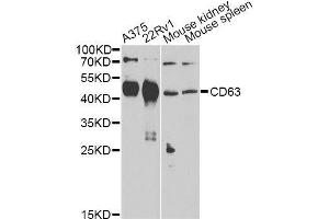 Western blot analysis of extracts of various cell lines, using CD63 Antibody. (CD63 抗体)