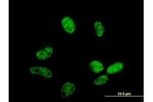 Immunofluorescence (IF) image for anti-Zinc Finger CCCH-Type Containing 14 (ZC3H14) (AA 1-306) antibody (ABIN529117)
