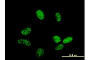Immunofluorescence of purified MaxPab antibody to ZC3H14 on HeLa cell. (ZC3H14 抗体  (AA 1-306))