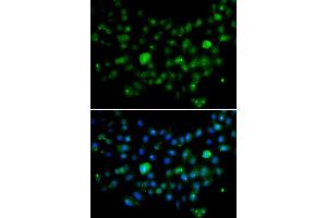 Immunofluorescence analysis of A549 cell using MCM10 antibody. (MCM10 抗体)