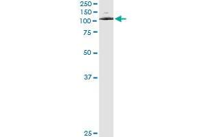 Immunoprecipitation (IP) image for anti-ATPase, Ca++ Transporting, Type 2C, Member 1 (ATP2C1) (AA 119-269) antibody (ABIN565309)