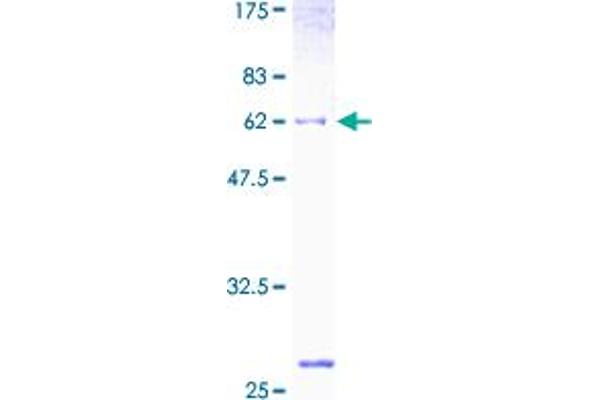 GALE Protein (AA 1-348) (GST tag)