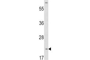 Western Blotting (WB) image for anti-Von Hippel-Lindau Tumor Suppressor, E3 Ubiquitin Protein Ligase (VHL) antibody (ABIN2905637) (VHL 抗体)