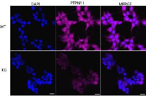 Immunocytochemical staining of HeLa cells using PTPN11 antibody (ABIN7800040), 1:1,000), Top panel: wild-type (WT), Bottom panal: PTPN11 shRNA knockdown (KD).