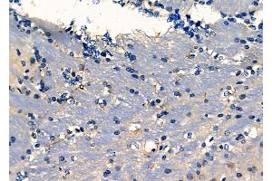 ABIN6261819 and ABIN6278083 at 1/100 staining Mouse brain tissue by IHC-P.