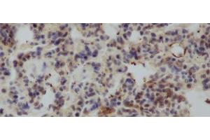 Immunohistochemistry of paraffin-embedded Rat lung using IL4 Polyclonal Antibody at dilution of 1:50 (IL-4 抗体)