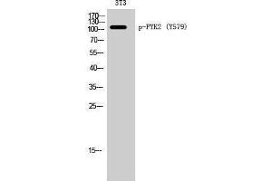 Western Blotting (WB) image for anti-PTK2B Protein tyrosine Kinase 2 beta (PTK2B) (pTyr579) antibody (ABIN3179709) (PTK2B 抗体  (pTyr579))