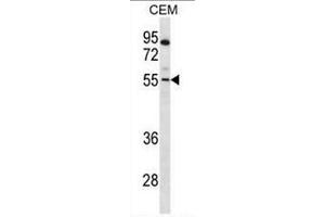 PAX7 Antibody (Center) western blot analysis in CEM cell line lysates (35µg/lane). (PAX7 抗体  (Middle Region))