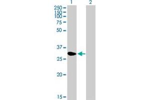 Western Blot analysis of NME5 expression in transfected 293T cell line by NME5 MaxPab polyclonal antibody.