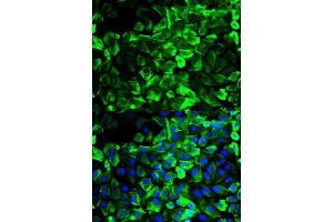 Immunofluorescence analysis of HeLa cell using TPM1 antibody. (Tropomyosin 抗体  (AA 1-245))