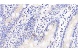 Detection of MMP10 in Human Small intestine Tissue using Polyclonal Antibody to Matrix Metalloproteinase 10 (MMP10) (MMP10 抗体  (AA 99-476))
