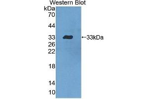 Western Blotting (WB) image for anti-Signal Transducer and Activator of Transcription 5B (STAT5B) (AA 497-749) antibody (ABIN3206169) (STAT5B 抗体  (AA 497-749))