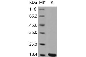 Western Blotting (WB) image for Interleukin 1, beta (IL1B) (Active) protein (ABIN7321252) (IL-1 beta 蛋白)