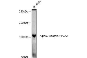 Western blot analysis of extracts of SH-SY5Y cells, using Alph-adaptin/ antibody (ABIN6130980, ABIN6136955, ABIN6136957 and ABIN6221039) at 1:1000 dilution. (AP2A2 抗体  (AA 590-939))