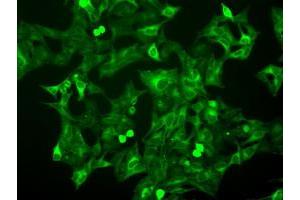 Image no. 9 for anti-Budding Uninhibited By Benzimidazoles 1 Homolog beta (Yeast) (BUB1B) antibody (ABIN1496995) (BUB1B 抗体)