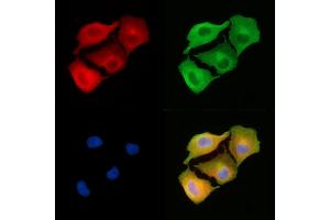 ABIN6261000 and ABIN6279252 staining  cells by IF/ICC.