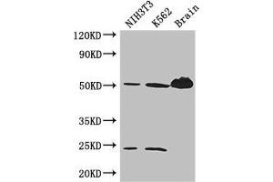 Western Blot Positive WB detected in: NIH/3T3 whole cell lysate, K562 whole cell lysate, Mouse brain tissue All lanes: TUBA4A antibody at 3 μg/mL Secondary Goat polyclonal to rabbit IgG at 1/50000 dilution Predicted band size: 50, 49 kDa Observed band size: 50, 24 kDa (TUBA4A 抗体  (AA 20-183))