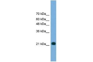 Western Blotting (WB) image for anti-Myosin Light Chain 4, Alkali, Atrial, Embryonic (MYL4) (N-Term) antibody (ABIN2786542)