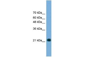 WB Suggested Anti-MYL4 Antibody Titration: 0. (MYL4 抗体  (N-Term))