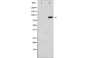 Western Blotting (WB) image for anti-Signal Transducer and Activator of Transcription 6, Interleukin-4 Induced (STAT6) (pTyr641) antibody (ABIN6256781)
