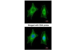ICC/IF Image Immunofluorescence analysis of paraformaldehyde-fixed HeLa, using PSPH, antibody at 1:200 dilution. (PSPH 抗体)