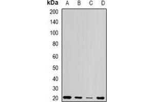 Western blot analysis of Centrin-1 expression in Jurkat (A), Hela (B), mouse testis (C), rat testis (D) whole cell lysates. (Centrin 1 抗体)