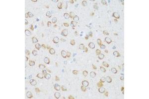 Immunohistochemistry of paraffin-embedded mouse brain using DHODH antibody. (DHODH 抗体  (AA 116-395))